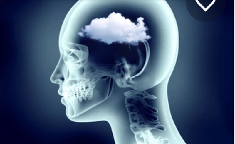 Chứng Sương mù não gây lú lẫn sau khi mắc covid-19 Xin đừng coi thường sức khỏe